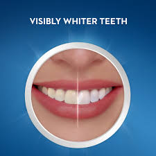 Dental Whitestrips - Advanced Teeth Whitening Strips - výrobce - forum - lékárna