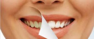 Snowhite Teeth Whitening - bělení zubů – výrobce – krém – forum