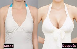 Ovashape – pro zvětšení prsou - jak používat – Amazon – kapky